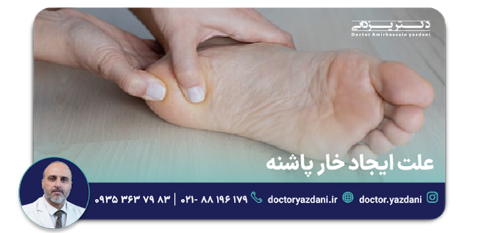 علت ایجاد خار پاشنه